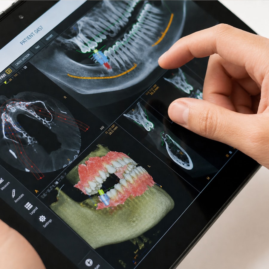 Planification chirurgicale sur radiographie 3D